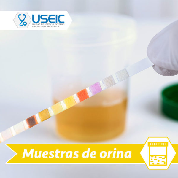 Ácido úrico en orina