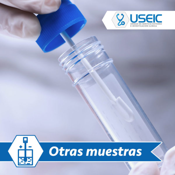 Cultivo de expectoración